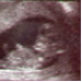 BetterPhoto Member