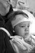 After Surgery