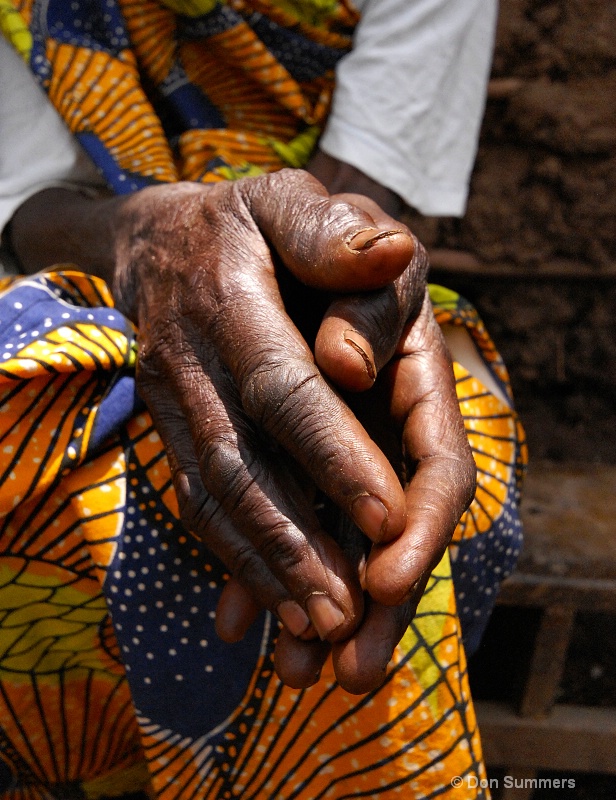 Strong but Gentle Hands, Rwanda 2008