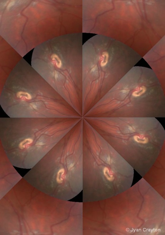 25