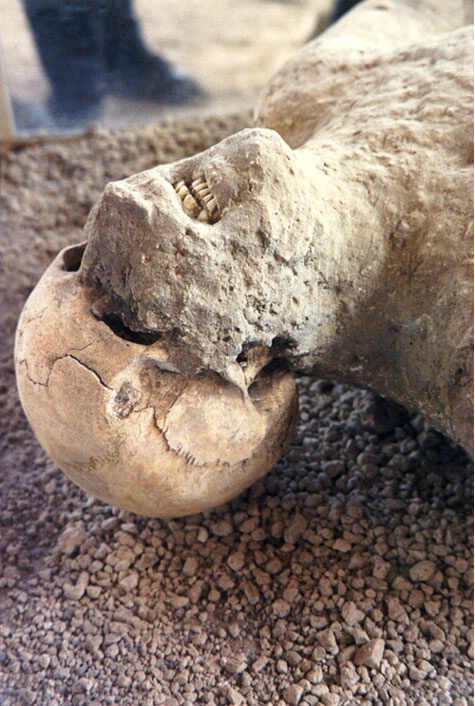 Pompeii's Victim