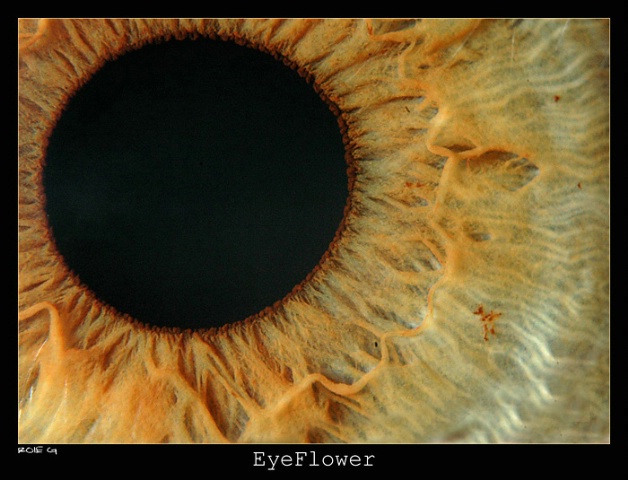 Eyeflower