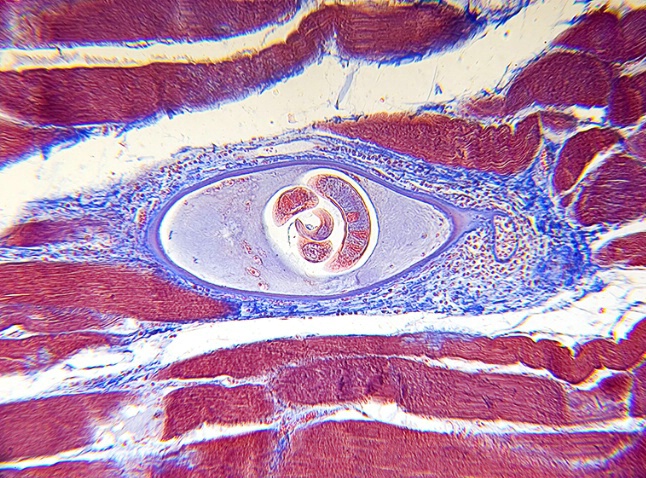 Trichinella spiralis - ID: 1844575 © Carolina K. Smith