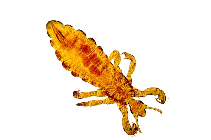 Photomicrograph - Pediculus humanus humanus (Lice) - ID: 5293342 © Carolina K. Smith