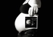 First Picture