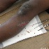 © Roberta E. Wall PhotoID# 11962479: wound 2